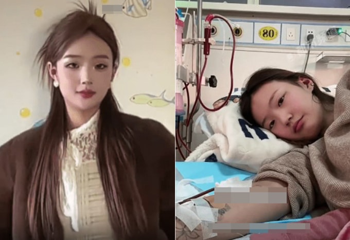 Xiao Ran mắc ure huyết nhưng lại lầm tưởng tăng cân quá đà. Ảnh: Douyin