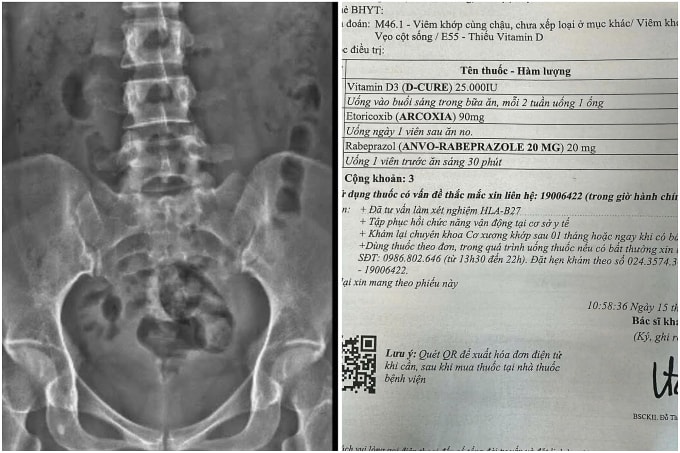 Kết quả chụp phim và một đơn thuốc của Linh sau thăm khám. Ảnh: Nhân vật cung cấp