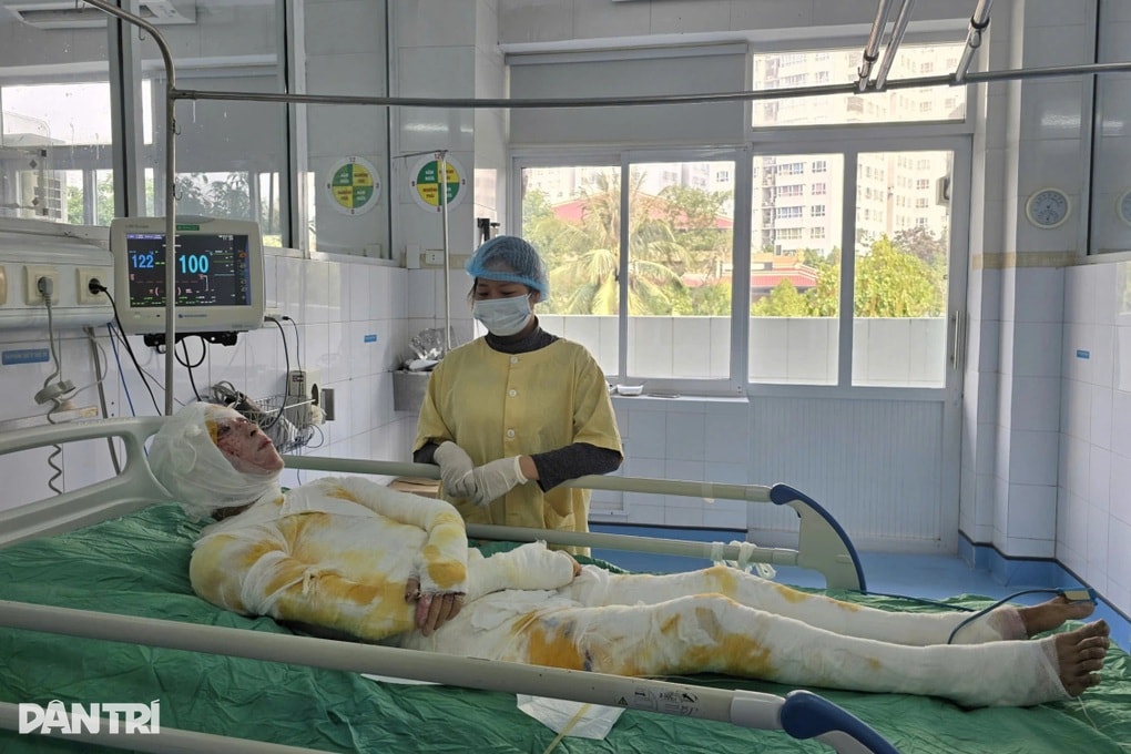 Bạn đọc Dân trí tiếp sức người bố đơn thân bị bỏng nặng hơn 400 triệu đồng - 2