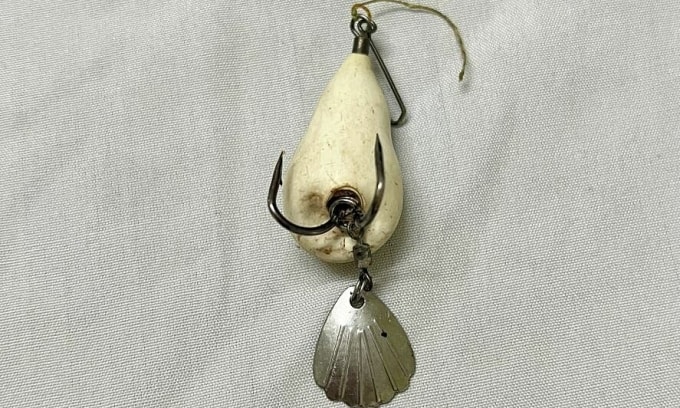 Nhiều trẻ mù loà do bị lưỡi câu cá móc vào mắt