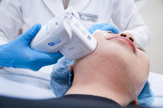 Bác sĩ dùng công nghệ HIFU xóa nọng cằm, thon gọn đường viền hàm cho một phụ nữ. Ảnh minh họa: Bệnh viện Đa khoa Tâm Anh