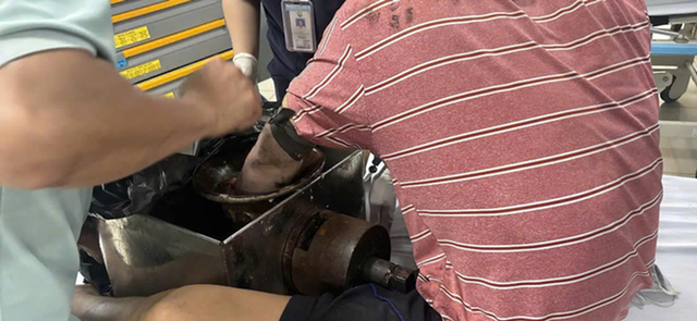 Tai nạn lao động cận Tết: Một phút lơ là hệ lụy lâu dài - Ảnh 1.