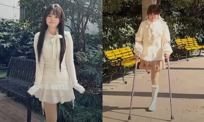 Mặc dù mất một chân, Thế Vĩ luôn lạc quan và tự lập trong cuộc sống. Ảnh: Douyin