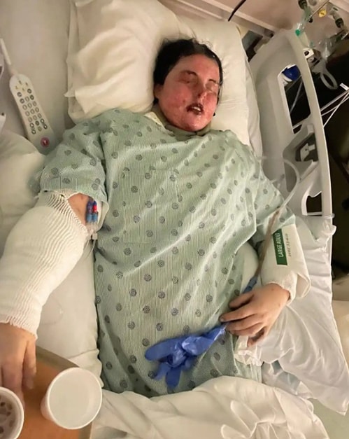 Emily McAllister hiện điều trị trong bệnh viện. Ảnh: Kennedy News