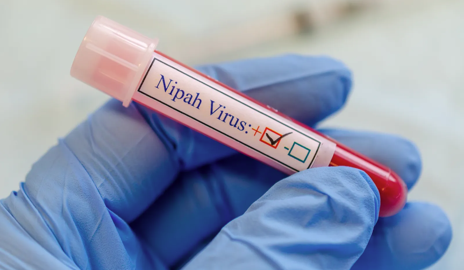 Virus Nipah có nguy hiểm như Covid-19? 