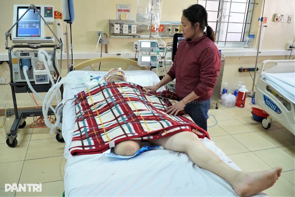 Người cha cụt chân bị đột quỵ, 4 con thơ ngơ ngác, vợ nghèo cầu cứu - 1