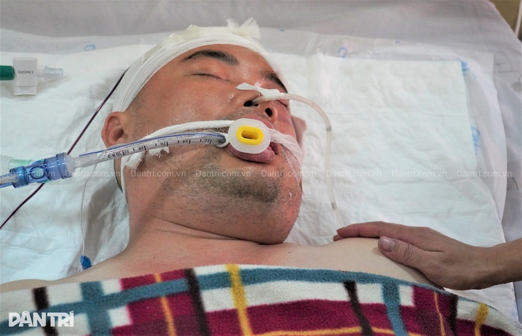 Người cha cụt chân bị đột quỵ, 4 con thơ ngơ ngác, vợ nghèo cầu cứu - 2