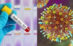 Virus Nipah nguy hiểm: Mối đe dọa âm ỉ khiến nhiều nước trên thế giới luôn trong trạng thái cảnh giác - Ảnh 3.
