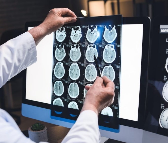 Ảnh minh họa: Central coastneurology