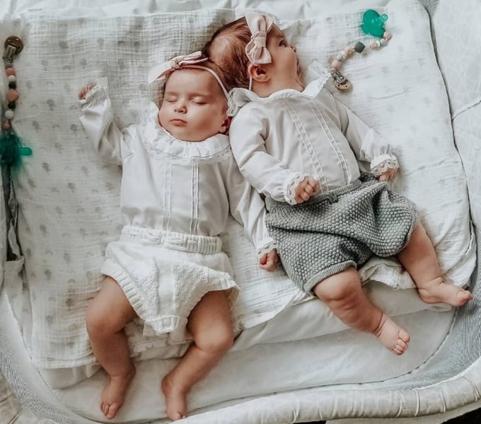 Abigail (trái) và Micaela khi cả hai còn dính liền. Ảnh: Liliya Bachinskaya