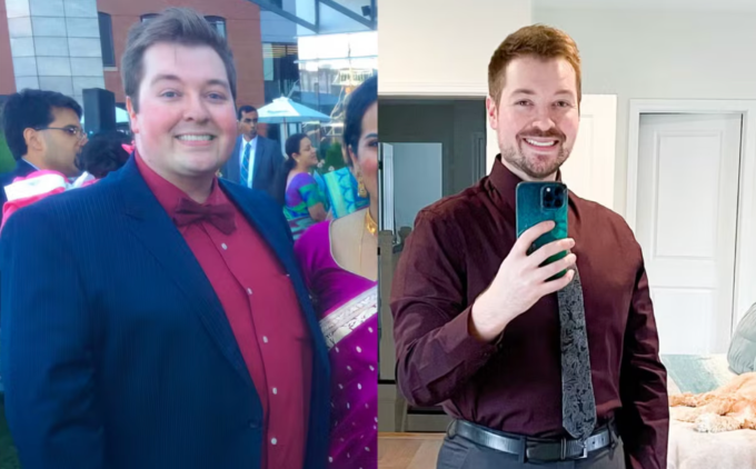 Nam bác sĩ giảm 56 kg sau 18 tháng kiên trì. Ảnh: Kevin Gendreau