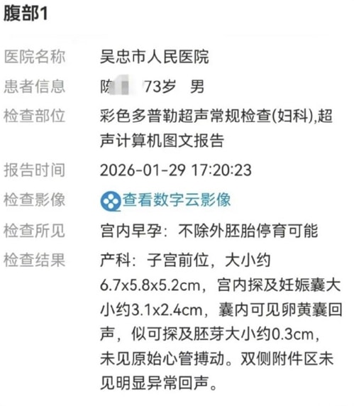 Báo cáo kết quả siêu âm của bệnh nhân họ Trần, 73 tuổi, hôm 29/1 cho thấy thai sớm trong tử cung: Không loại trừ khả năng thai ngừng phát triển. Ảnh: Sohu