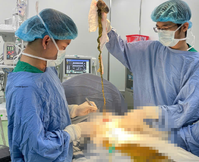 Bé trai "bụng cứng như đá", bố mẹ liền đưa đi gặp bác sĩ - Ảnh 1.