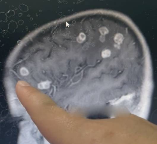 Bé gái sốt liên tục 17 ngày, bác sĩ sốc nặng khi phát hiện "bí mật" đáng sợ- Ảnh 1.