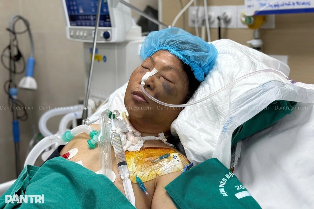 Mỗi ngày viện phí 20 triệu, con trai bất lực nhìn mẹ giành giật sự sống - 3