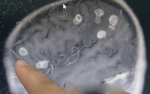 Bé trai bị sốt và co giật, bác sĩ phát hiện ra điều đáng sợ - Ảnh 2.