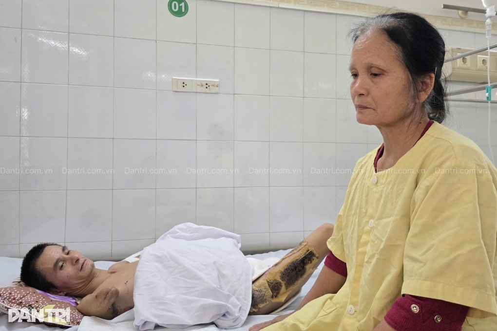 Từ trụ cột thành tàn phế: Lời cầu cứu xé lòng của người bố hai con - 3