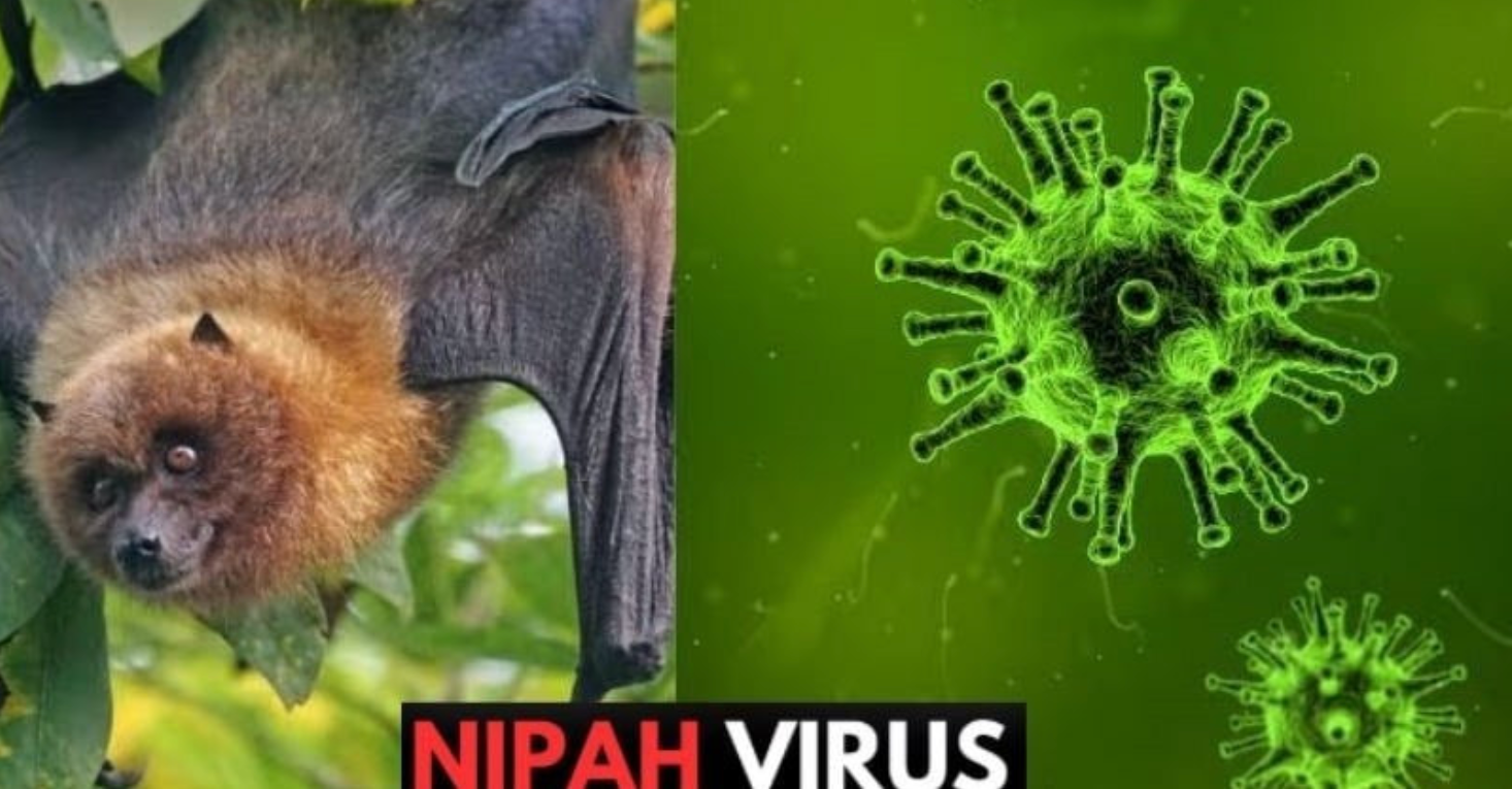 Virus Nipah được xếp vào nhóm bệnh truyền nhiễm loại A, với tỷ lệ tử vong được báo cáo từ 40 đến 75%. (Ảnh minh họa: moh.gov.vn)