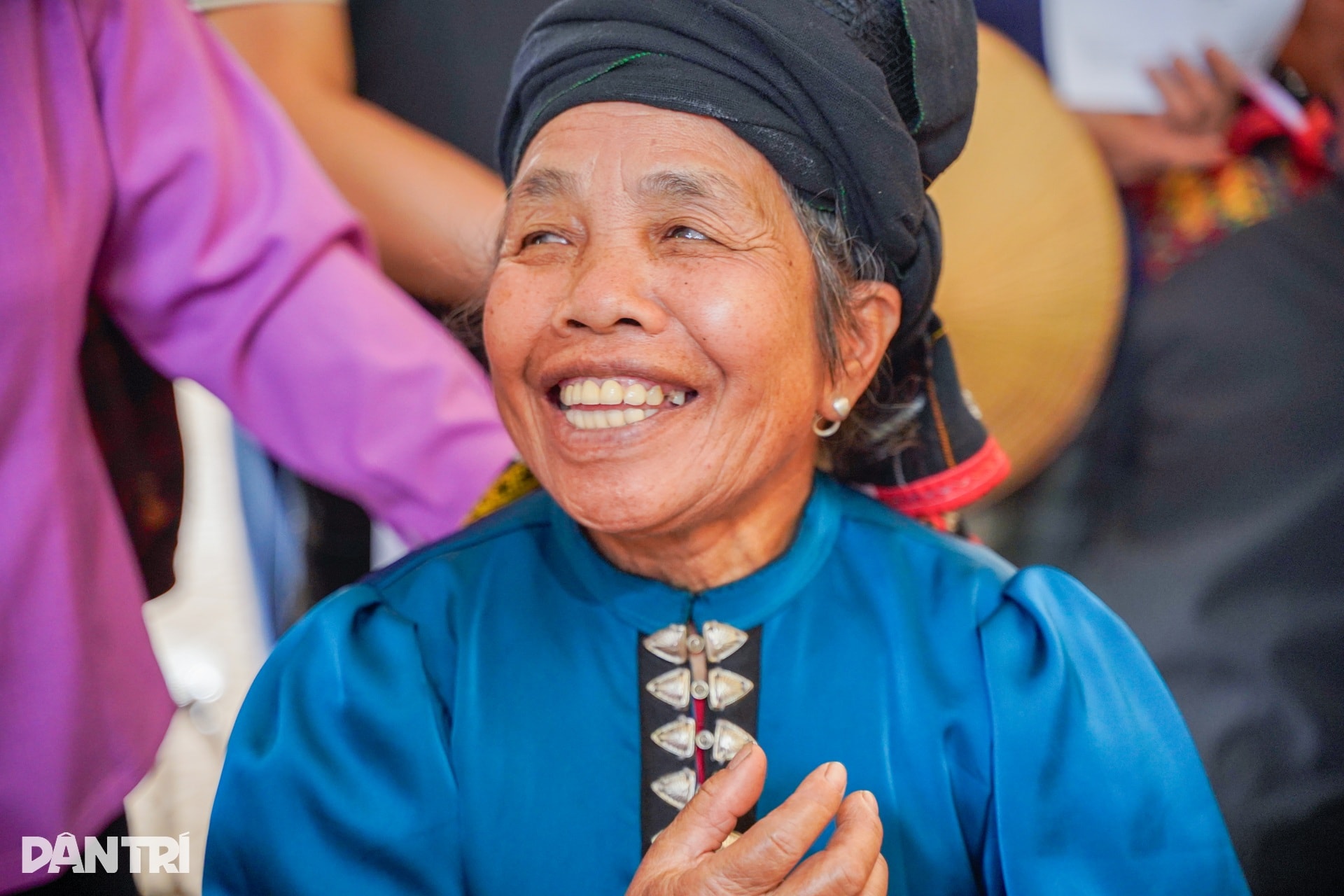 Nhiều người dân vùng biên giới Sơn La mắc gan nhiễm mỡ, xơ gan - 6