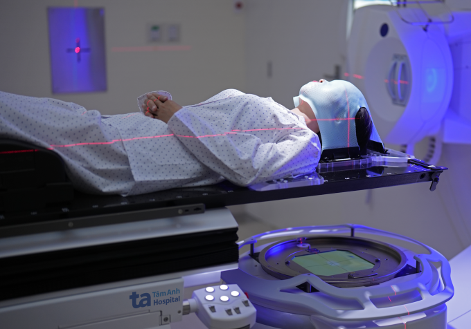 Người bệnh xạ trị u não sau phẫu thuật với mặt nạ cố định. Ảnh: Bệnh viện Đa khoa Tâm Anh