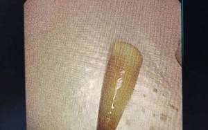 Bé trai 5 tháng tuổi nguy kịch vì ông cho "nếm thử" rượu bằng đầu đũa - Ảnh 3.