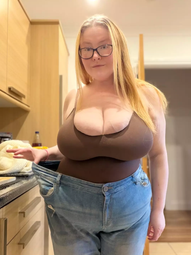 Tianna đã nhận được chẩn đoán chính xác: cô mắc chứng Gigantomastia (phì đại tuyến vú cực độ). Ảnh: LADbible