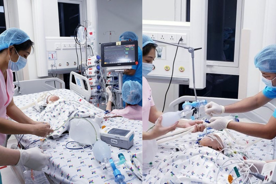 Sau khi được tách rời, bé Diệu Nhi ở lại phòng mổ cũ, bé Trúc Nhi được chuyển sang phòng mổ kế bên. Diệu Nhi được giữ lại hậu môn thật và ½ đại tràng trái, Trúc Nhi được giữ lại đoạn hồi tràng chung