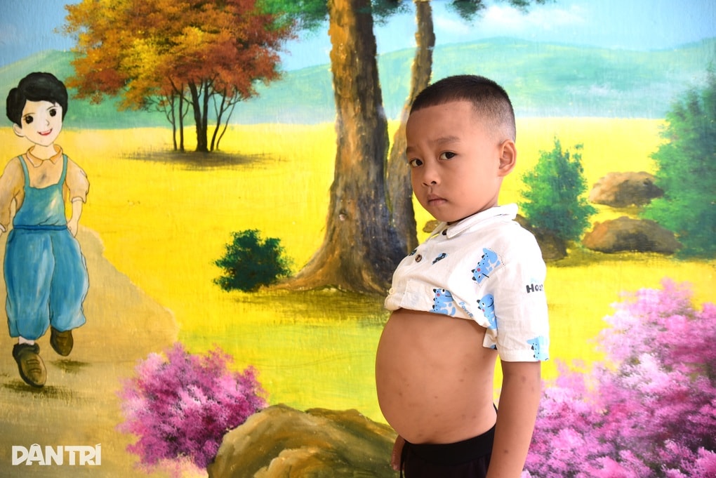 Mắc bệnh hiểm nghèo, bé trai vùng cao nguy cơ dang dở việc học - 2