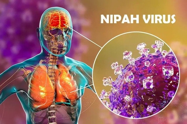 Giám sát và phòng bệnh do virus Nipah ở người thế nào?- Ảnh 2.