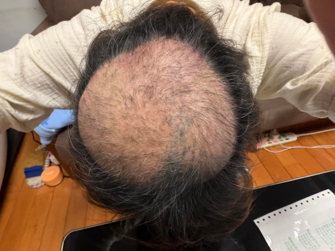 Tiệm đậu hũ thối khiến người dân bị loạn thần