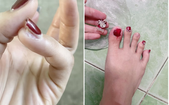 Tai nạn nhớ đời của các chị em khi úp móng chân, tay diện Tết. Ảnh: TikTok