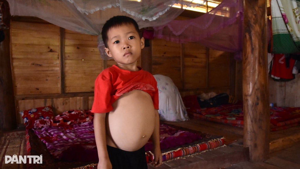 “Cô ơi, con mổ lách thành công rồi!” - 2