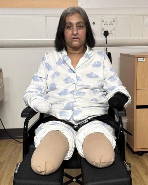 Người phụ nữ phải cắt bỏ tứ chi nghi do vết chó liếm