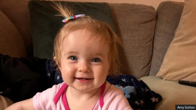 Bé Dolly hiện đã hồi phục hoàn toàn. Ảnh: Amy Sutton