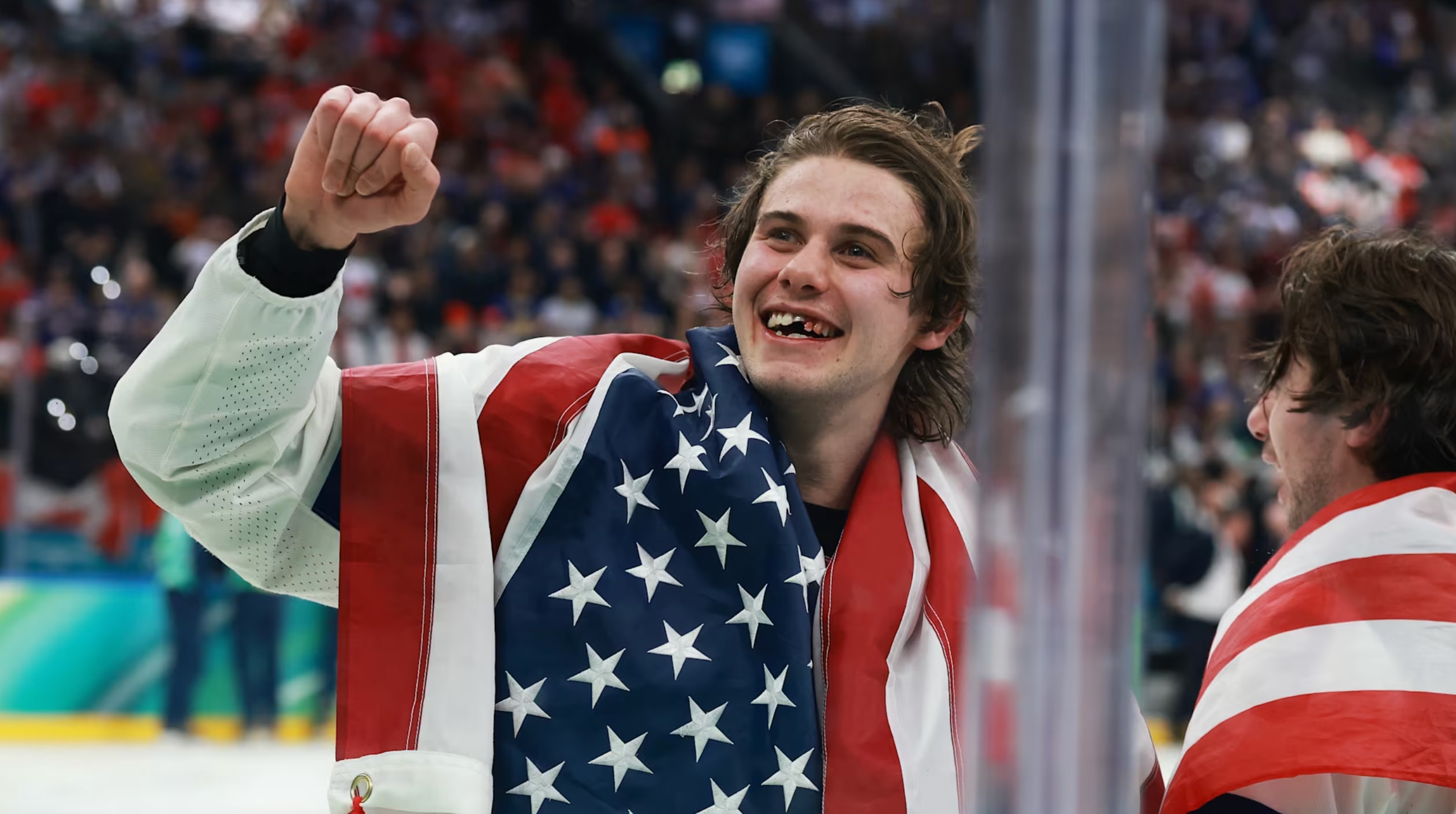 Dù bị đánh gãy răng, Hughes vẫn không giấu được niềm vui sau trận đấu. (Nguồn: Olympics)