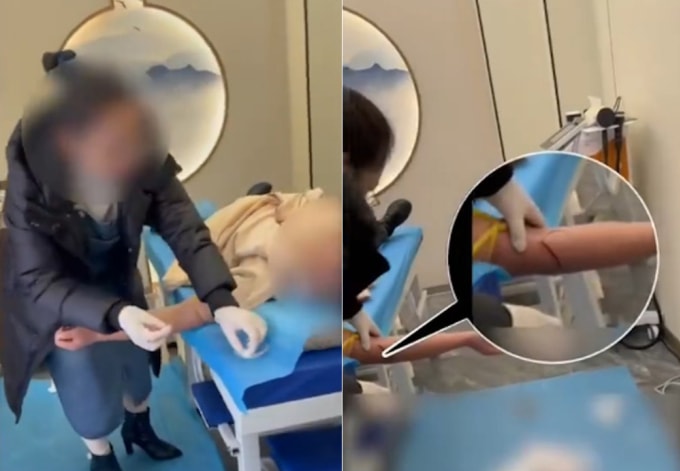 Những người tự xưng là bác sĩ tại một cơ sở y tế đang trích máu trị liệu để loại bỏ tà khí khỏi cơ thể bệnh nhân.