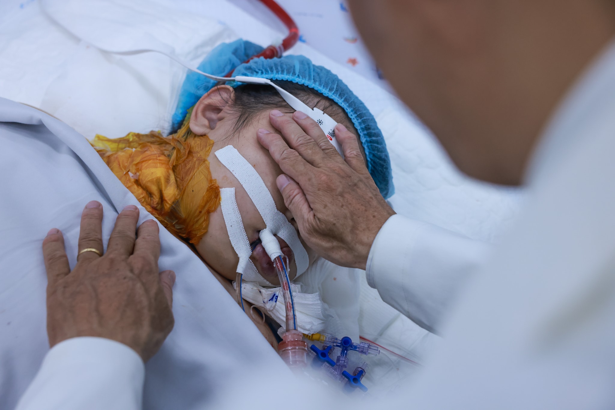 Viêm cơ tim, suy tim, suy gan, suy thận, xuất huyết não v.v là những biến chứng nguy hiểm do sốt xuất huyết Dengue có thể gây ra. 