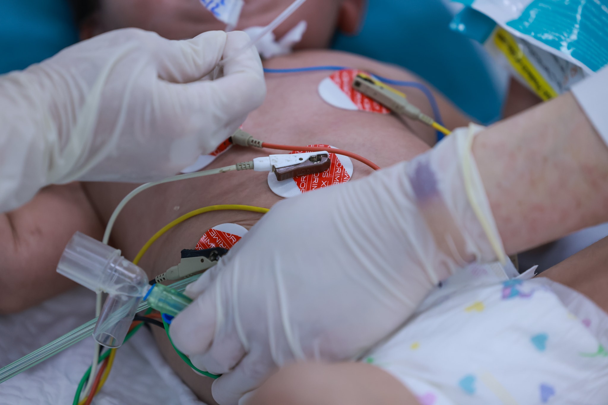 Trẻ em là một trong những đối tượng nguy cơ của sốt xuất huyết Dengue. Ngoài ra, bệnh còn tiềm ẩn nguy cơ biến chứng cao đối với phụ nữ mang thai, người cao tuổi và các trường hợp có bệnh lý nền như béo phì, tiểu đường, tim mạch... 