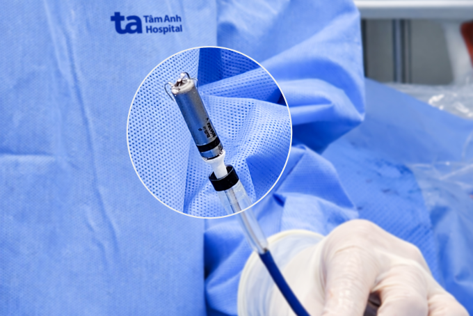 Bác sĩ cấy máy tạo nhịp không dây Micra AV2 cho người bệnh. Ảnh: Bệnh viện Tâm Anh