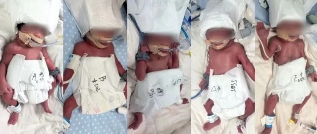 Người phụ nữ 24 tuổi sinh 5 hiếm gặp- Ảnh 1.