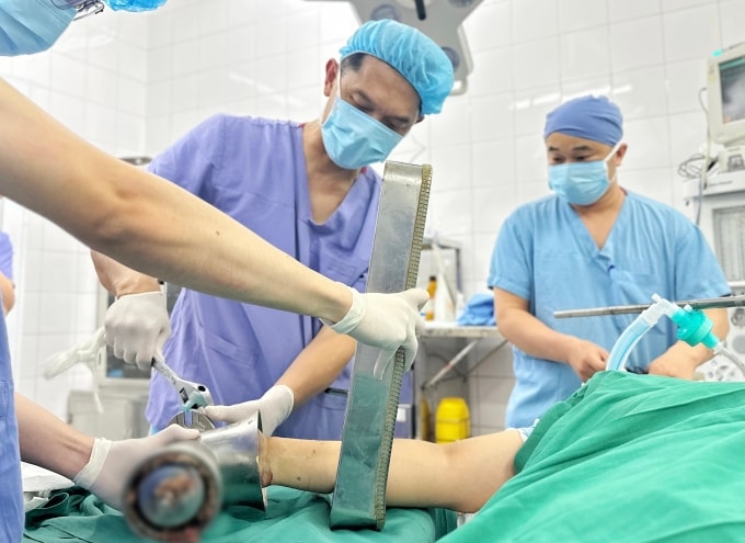 Các bác sĩ tháo máy xay khỏi tay bệnh nhân. Ảnh: Thái Ngọc