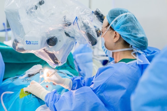 GS Chung Thủy đang phẫu thuật đặt điện cực ốc tai cho bệnh nhi qua kính hiển vi. Ảnh: Bệnh viện Đa khoa Tâm Anh