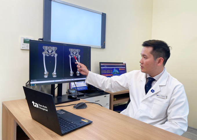 Bác sĩ Khoa đánh giá tình trạng khớp háng của anh Tình. Ảnh: Bệnh viện Đa khoa Tâm Anh