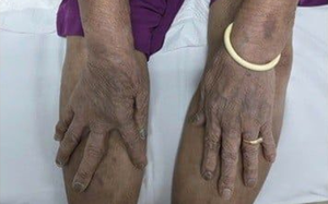 Cấp cứu 3 người bị co giật, hôn mê nghi ngộ độc sau bữa ăn trưa- Ảnh 2.