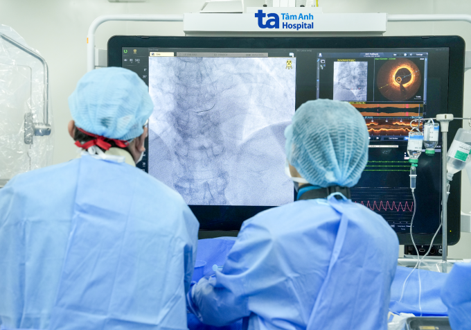 Bác sĩ Trung tâm Tim mạch Can thiệp đặt stent tái thông mạch vành hẹp nặng cho bệnh nhân. Ảnh: Bệnh viện Đa khoa Tâm Anh