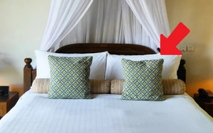 Kỳ lạ chàng trai có tới 42 răng, thừa 10 chiếc - Ảnh 5.