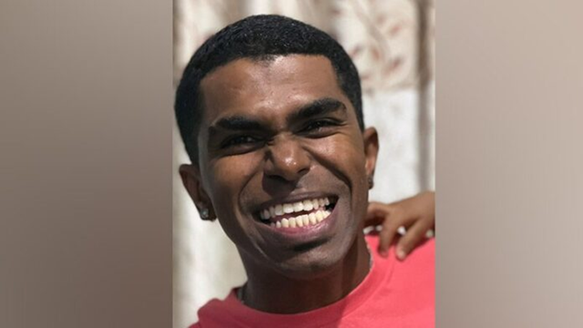 Người đàn ông nhiều răng nhất thế giới, bác sĩ lý giải nguyên nhân chuyện "xưa nay hiếm" - Ảnh 2.