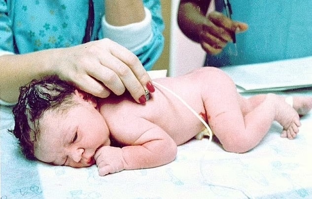 Elizabeth Carr khi chào đời năm 1981. Ảnh: Associated Press