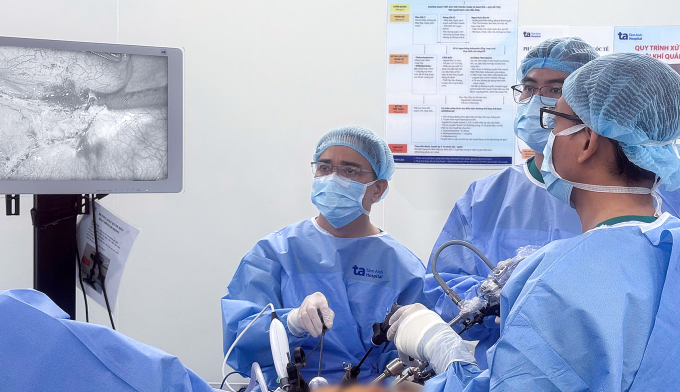 Bác sĩ Thái (gần màn hình) đang thực hiện phẫu cắt khối lồng ruột cho bà Chẩn. Ảnh: Bệnh viện Đa khoa Tâm Anh