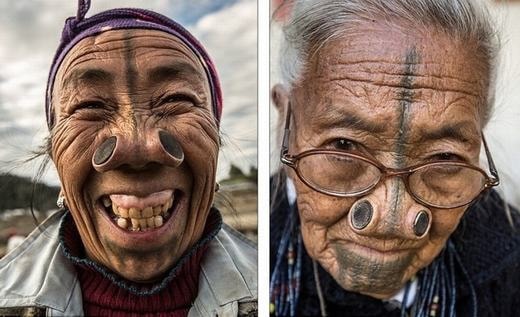 Làm đẹp kinh dị: "Cải tạo" bản thân, đục mũi để đẹp - Ảnh 1.